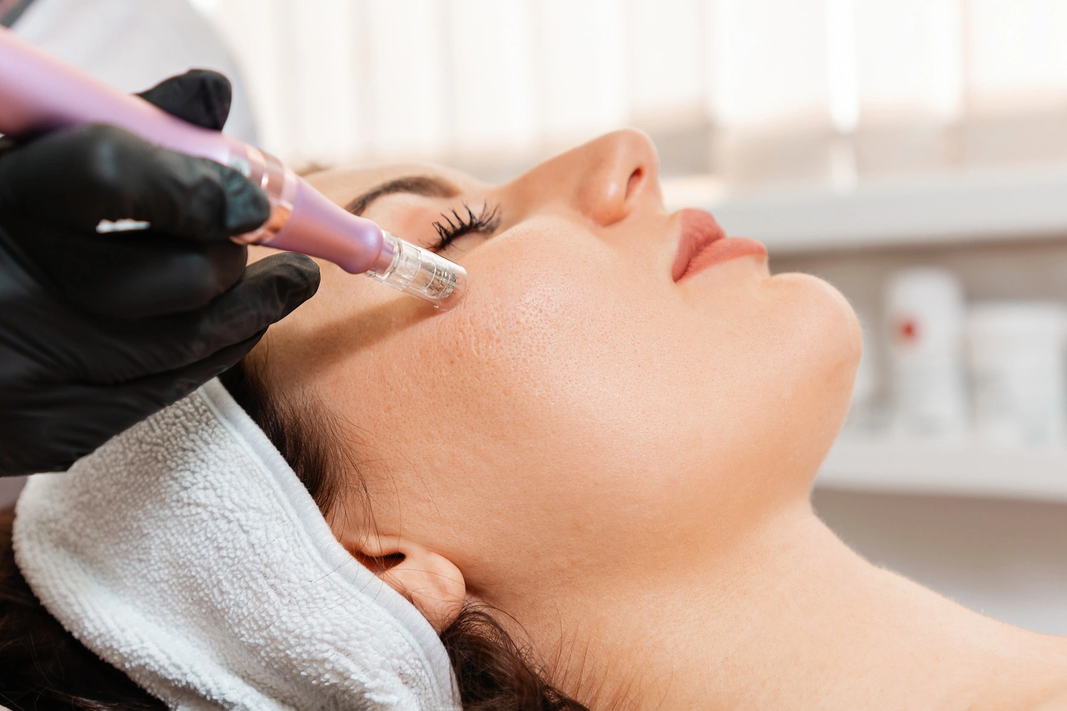 microneedling financing
